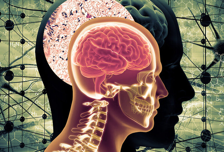 Ζάχαρη και εγκέφαλος: Είναι η νόσος του Αλτσχάιμερ πράγματι διαβήτης τύπου III;